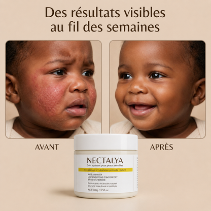 Nectalya — Soin apaisant pour peaux sensibles